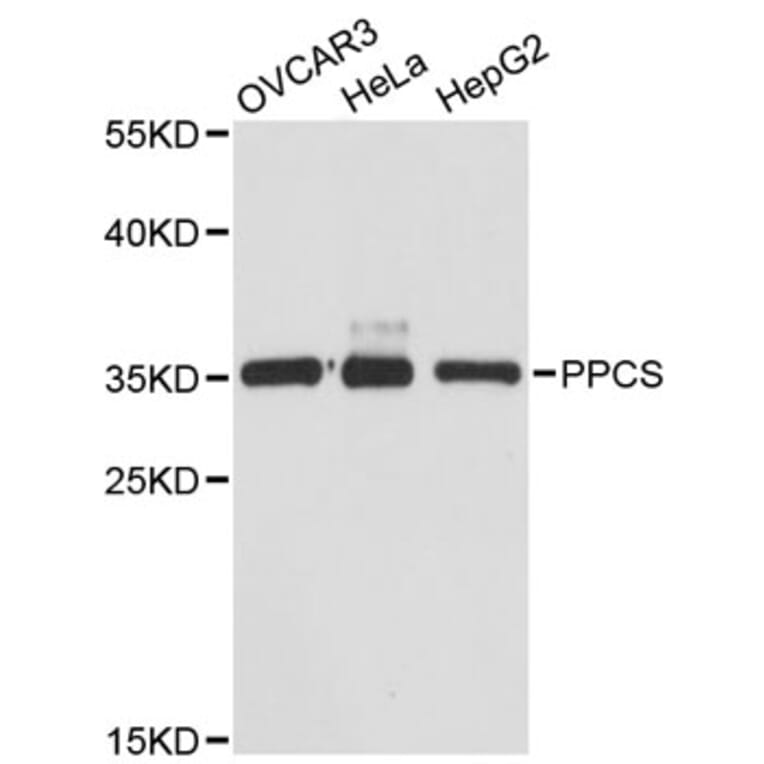 Western Blot - Anti-PPCS Antibody (A12828) - Antibodies.com