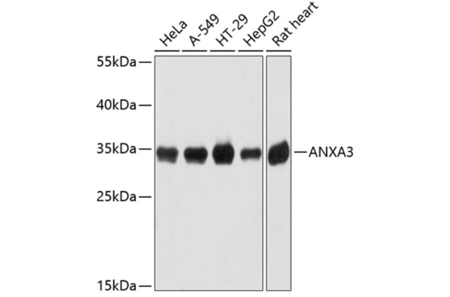 Western Blot - Anti-Annexin A3/ANXA3 Antibody (A89317) - Antibodies.com