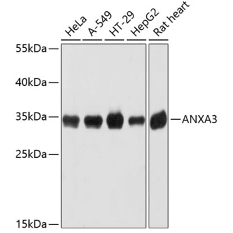 Western Blot - Anti-Annexin A3/ANXA3 Antibody (A89317) - Antibodies.com