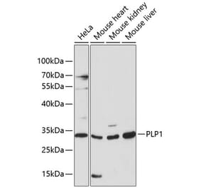 Western Blot - Anti-Myelin PLP Antibody (A89318) - Antibodies.com