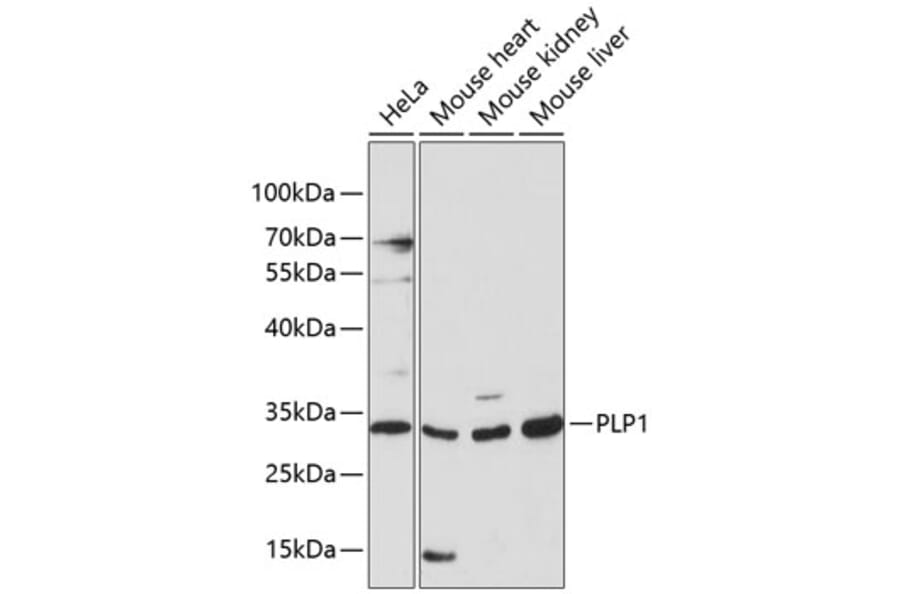 Western Blot - Anti-Myelin PLP Antibody (A89318) - Antibodies.com
