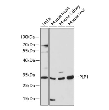 Western Blot - Anti-Myelin PLP Antibody (A89318) - Antibodies.com