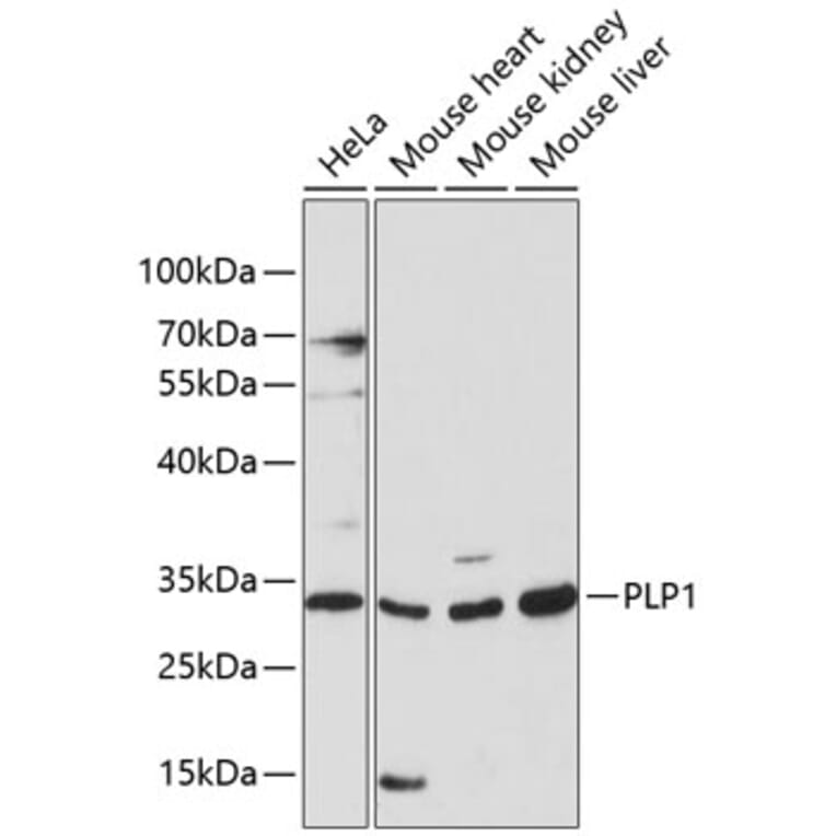 Western Blot - Anti-Myelin PLP Antibody (A89318) - Antibodies.com