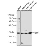Western Blot - Anti-Myelin PLP Antibody (A89318) - Antibodies.com