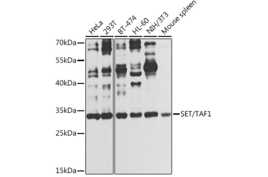 Western Blot - Anti-SET/TAF-I Antibody (A89319) - Antibodies.com