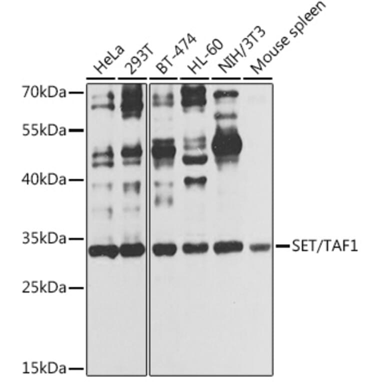 Western Blot - Anti-SET/TAF-I Antibody (A89319) - Antibodies.com