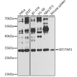 Western Blot - Anti-SET/TAF-I Antibody (A89319) - Antibodies.com