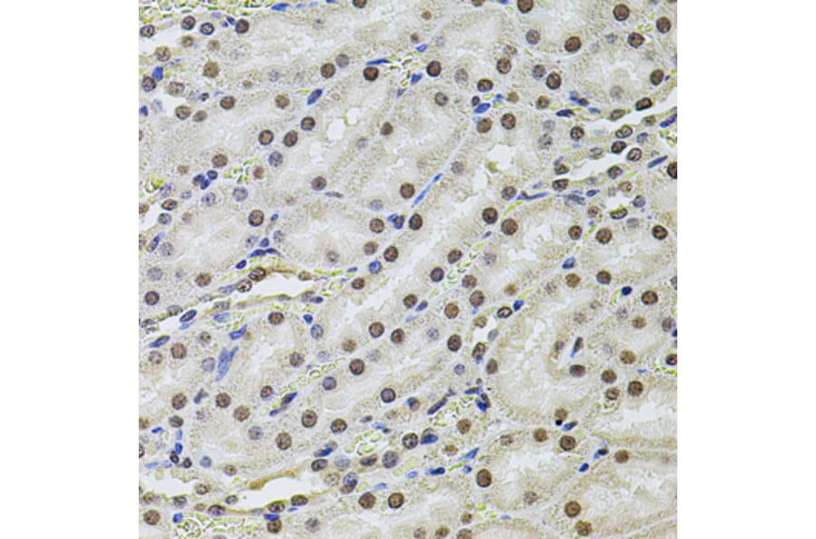 Immunohistochemistry - Anti-SET/TAF-I Antibody (A89319) - Antibodies.com
