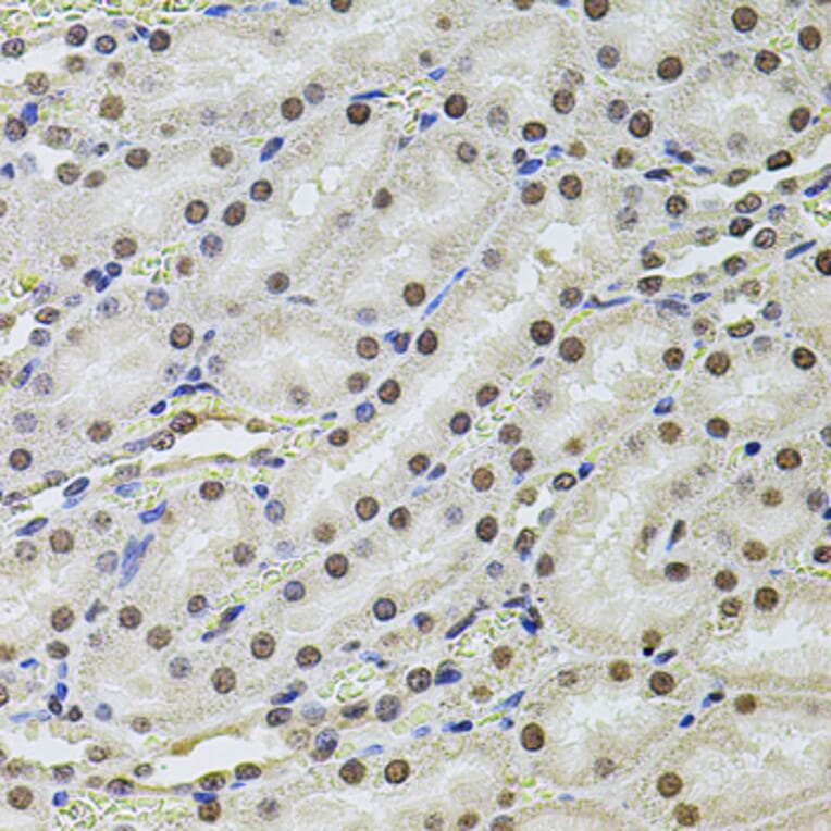 Immunohistochemistry - Anti-SET/TAF-I Antibody (A89319) - Antibodies.com