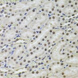 Immunohistochemistry - Anti-SET/TAF-I Antibody (A89319) - Antibodies.com