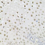 Immunohistochemistry - Anti-SET/TAF-I Antibody (A89319) - Antibodies.com