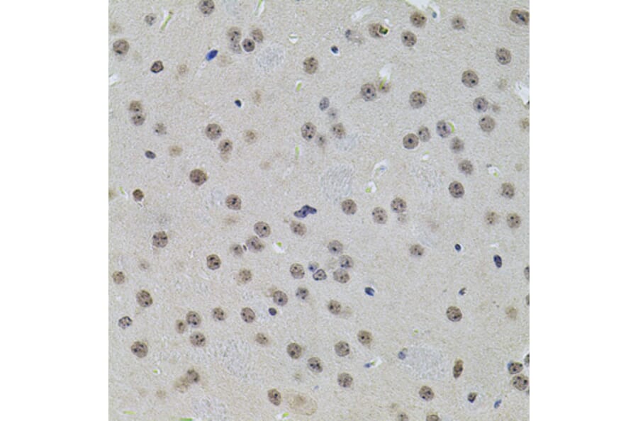 Immunohistochemistry - Anti-SET/TAF-I Antibody (A89319) - Antibodies.com