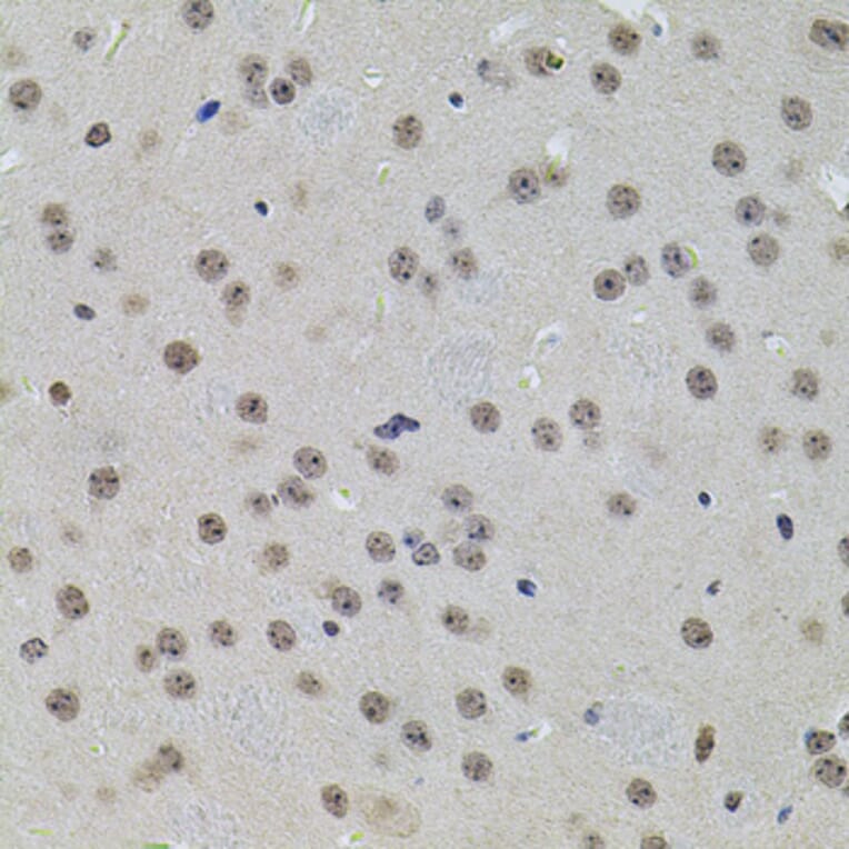 Immunohistochemistry - Anti-SET/TAF-I Antibody (A89319) - Antibodies.com