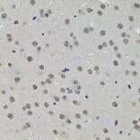 Immunohistochemistry - Anti-SET/TAF-I Antibody (A89319) - Antibodies.com