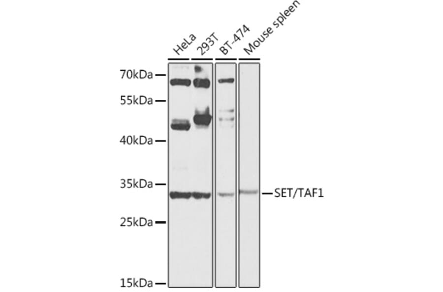 Western Blot - Anti-SET/TAF-I Antibody (A89320) - Antibodies.com