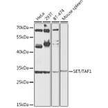 Western Blot - Anti-SET/TAF-I Antibody (A89320) - Antibodies.com