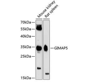 Western Blot - Anti-GIMAP5 Antibody (A89321) - Antibodies.com