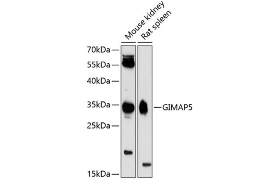 Western Blot - Anti-GIMAP5 Antibody (A89321) - Antibodies.com