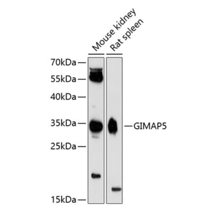 Western Blot - Anti-GIMAP5 Antibody (A89321) - Antibodies.com