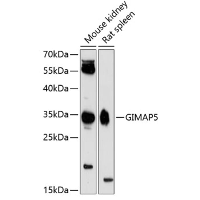 Western Blot - Anti-GIMAP5 Antibody (A89321) - Antibodies.com