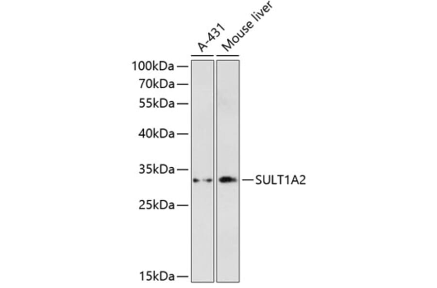 Western Blot - Anti-SULT1A2 Antibody (A89322) - Antibodies.com