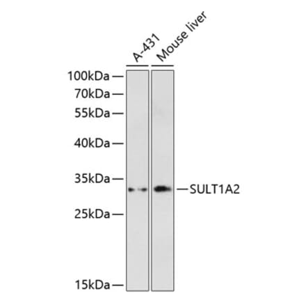 Western Blot - Anti-SULT1A2 Antibody (A89322) - Antibodies.com