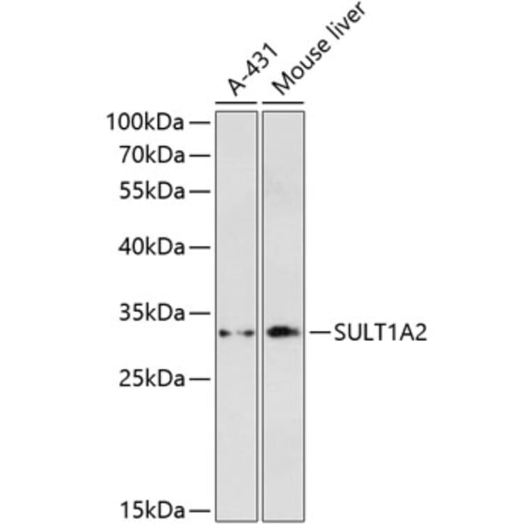Western Blot - Anti-SULT1A2 Antibody (A89322) - Antibodies.com