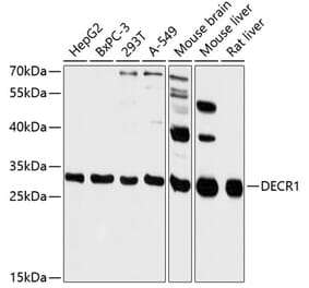 Western Blot - Anti-DECR1 Antibody (A89323) - Antibodies.com