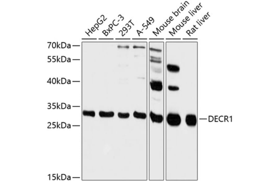 Western Blot - Anti-DECR1 Antibody (A89323) - Antibodies.com