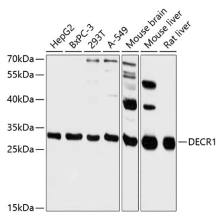 Western Blot - Anti-DECR1 Antibody (A89323) - Antibodies.com