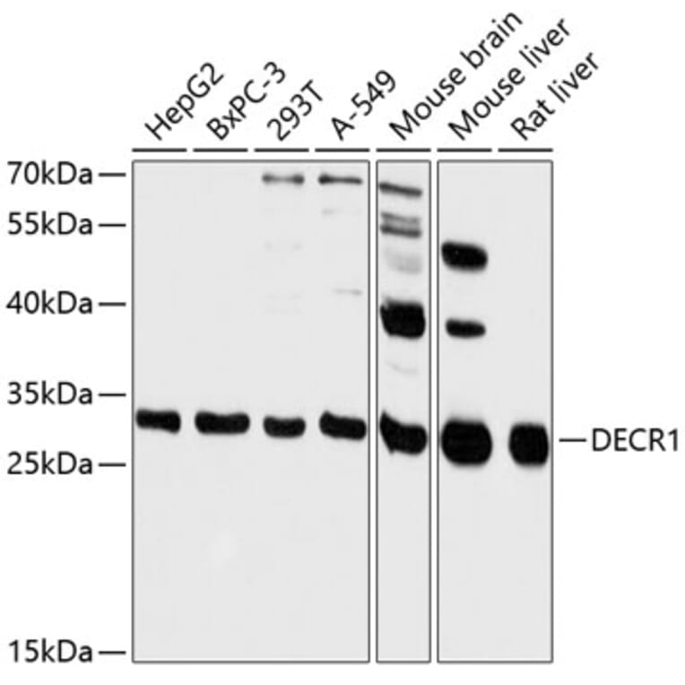 Western Blot - Anti-DECR1 Antibody (A89323) - Antibodies.com