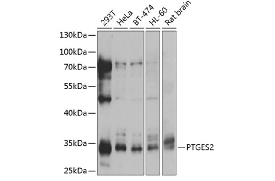 Western Blot - Anti-PTGES2/Gbf1 Antibody (A89324) - Antibodies.com