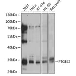 Western Blot - Anti-PTGES2/Gbf1 Antibody (A89324) - Antibodies.com
