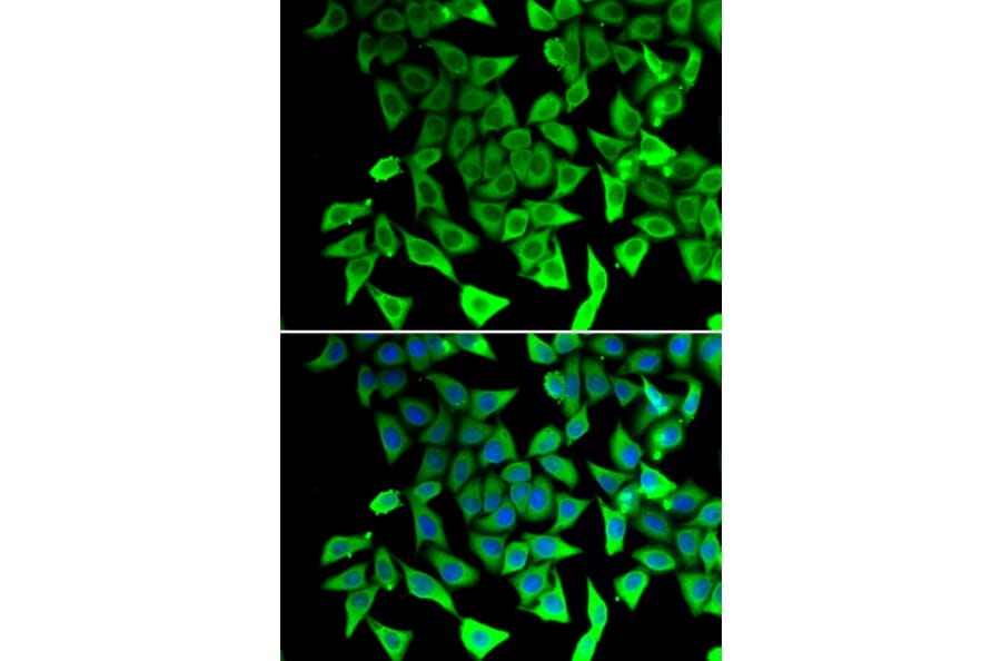 Immunofluorescence - Anti-PTGES2/Gbf1 Antibody (A89324) - Antibodies.com