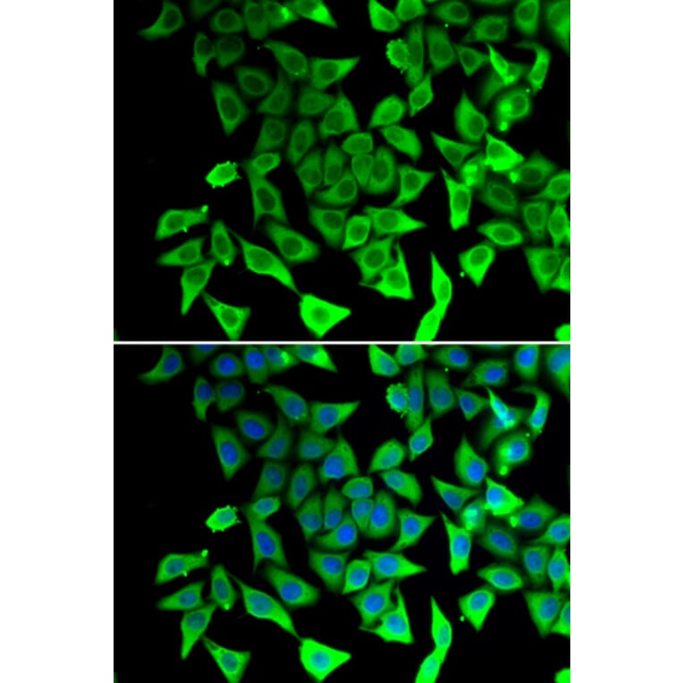 Immunofluorescence - Anti-PTGES2/Gbf1 Antibody (A89324) - Antibodies.com