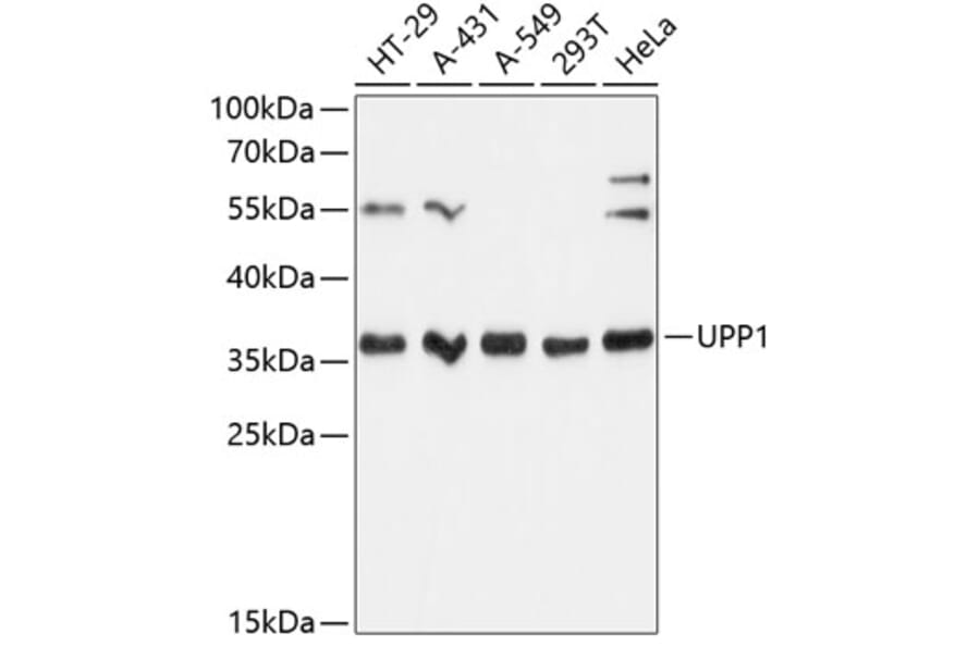Western Blot - Anti-Uridine Phosphorylase 1 Antibody (A89325) - Antibodies.com