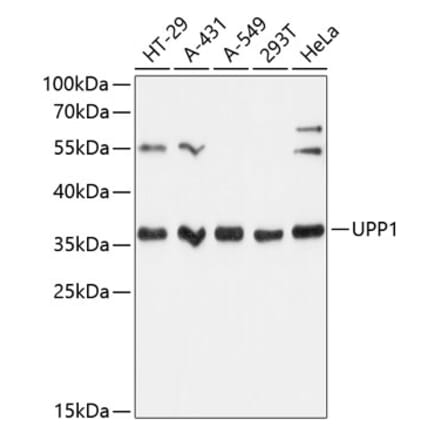 Western Blot - Anti-Uridine Phosphorylase 1 Antibody (A89325) - Antibodies.com