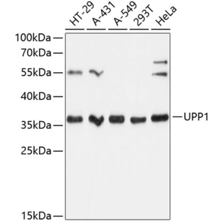 Western Blot - Anti-Uridine Phosphorylase 1 Antibody (A89325) - Antibodies.com