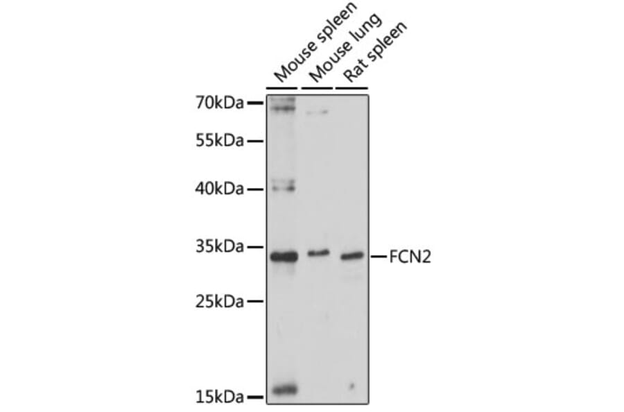 Western Blot - Anti-Ficolin 2 Antibody (A89326) - Antibodies.com