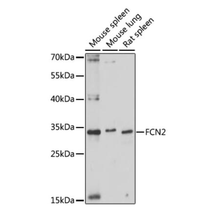 Western Blot - Anti-Ficolin 2 Antibody (A89326) - Antibodies.com