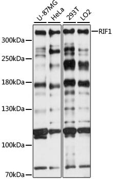 Western blot analysis of extracts of various cell lines, using Anti-RIF1 Antibody (A15167) at 1:1,000 dilution.
Secondary antibody: Goat Anti-Rabbit IgG (H+L) (HRP) (AS014) at 1:10,000 dilution.
Lysates / proteins: 25µg per lane.
Blocking buffer: 3% non-fat dry milk in TBST.
Detection: ECL Basic Kit (RM00020).
Exposure time: 30s.