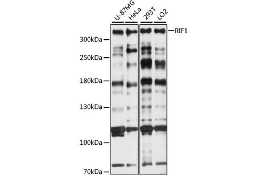 Western Blot - Anti-Rif1 Antibody (A89327) - Antibodies.com