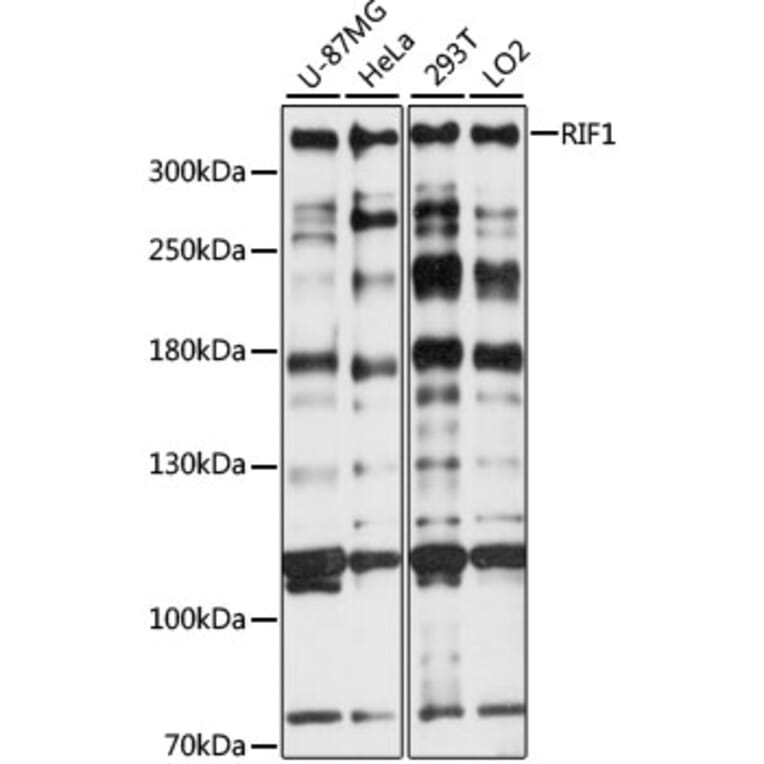 Western Blot - Anti-Rif1 Antibody (A89327) - Antibodies.com