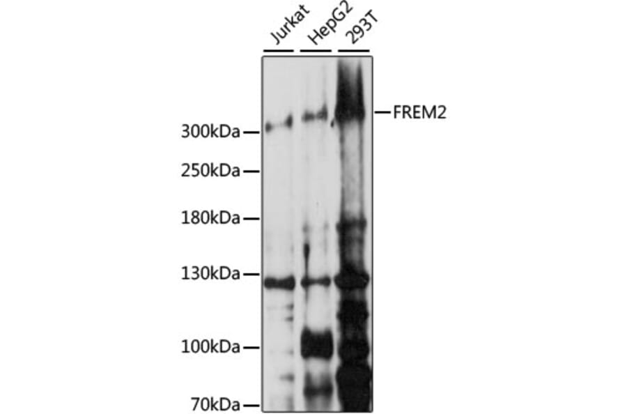 Western Blot - Anti-FREM2 Antibody (A89328) - Antibodies.com