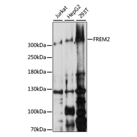 Western Blot - Anti-FREM2 Antibody (A89328) - Antibodies.com