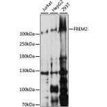 Western Blot - Anti-FREM2 Antibody (A89328) - Antibodies.com