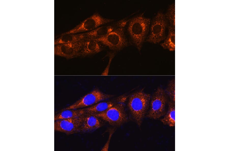 Immunofluorescence - Anti-FREM2 Antibody (A89328) - Antibodies.com