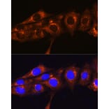 Immunofluorescence - Anti-FREM2 Antibody (A89328) - Antibodies.com