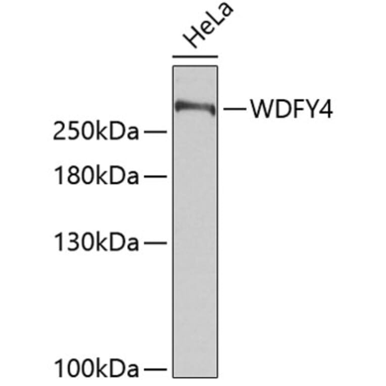 Western Blot - Anti-WDFY4 Antibody (A89329) - Antibodies.com