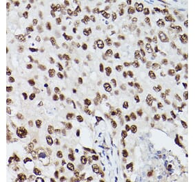 Immunohistochemistry - Anti-PSME3 Antibody (A89331) - Antibodies.com
